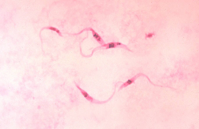 Die mikroskopische Aufnahme zeigt Trypanosoma cruzi in einem Blutaustrich. Die einzelligen Parasiten sind die Erreger der Chagas-Krankheit, die hauptsächlich in Mittel- und Südamerika verbreitet ist.