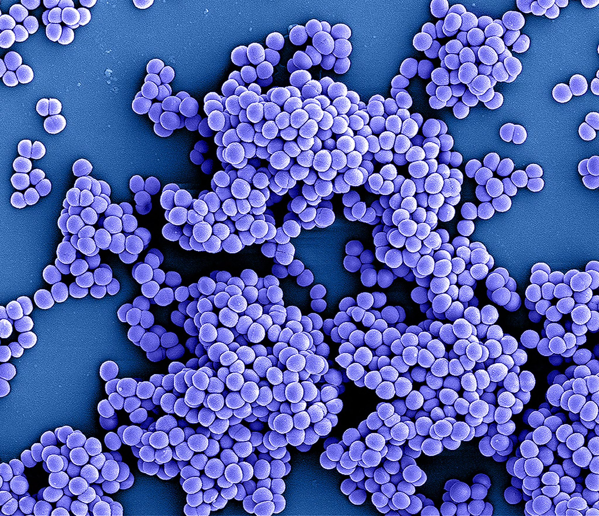 Koloriertes Bild von Methicillin-resistenten Staphylococcus aureus-Bakterien (MRSA); rasterelektronenmikroskopische Aufnahme, die in der NIAID Integrated Research Facility (IRF) in Fort Detrick, Maryland, aufgenommen wurde